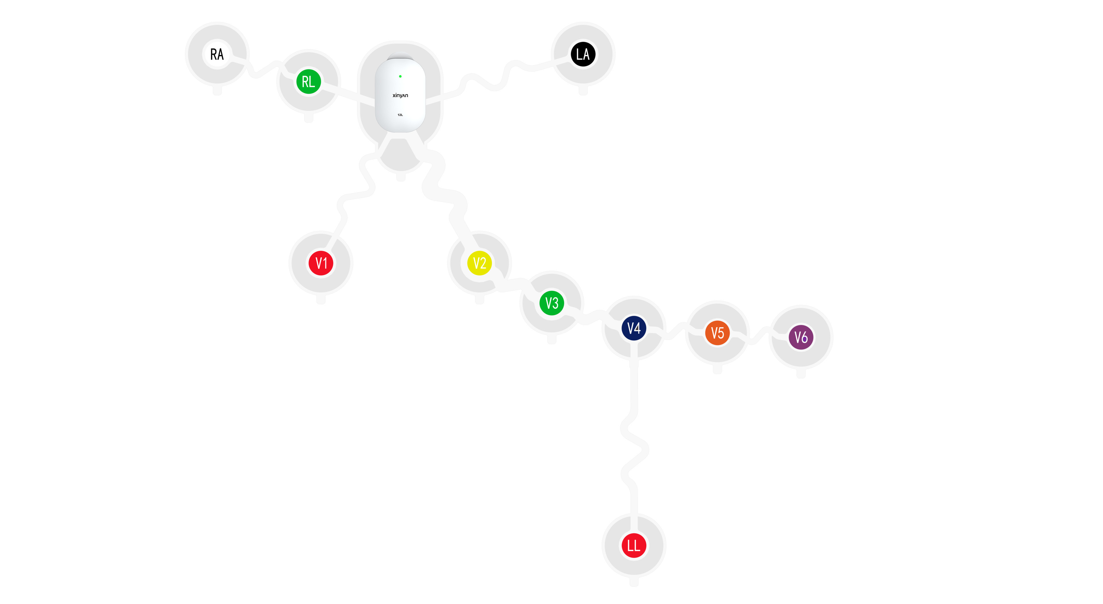 12-lead wearable ECG